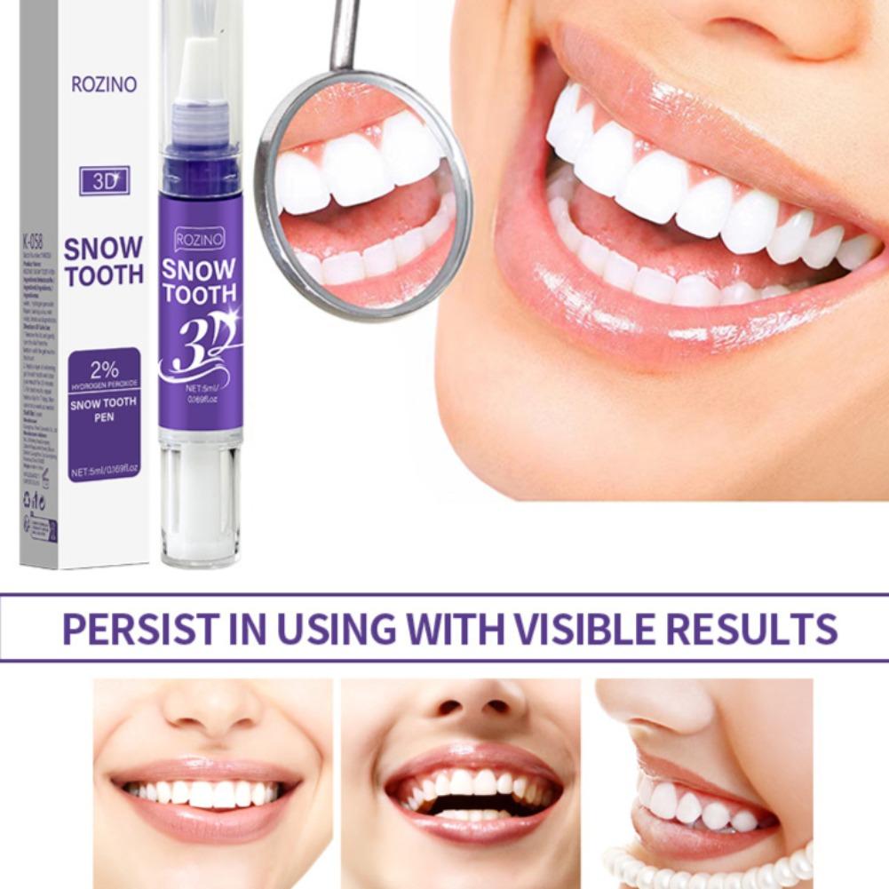 قلم تبييض الأسنان بتقنية ثلاثي - مراجعة Teeth Whitening Near Me وسعره